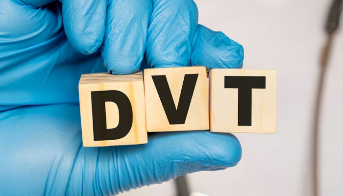Common Signs and Symptoms of DVT