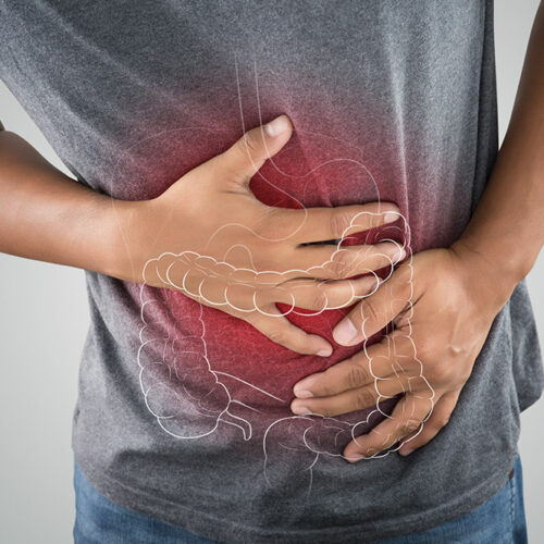 7 Risk Factors of Colon Cancer