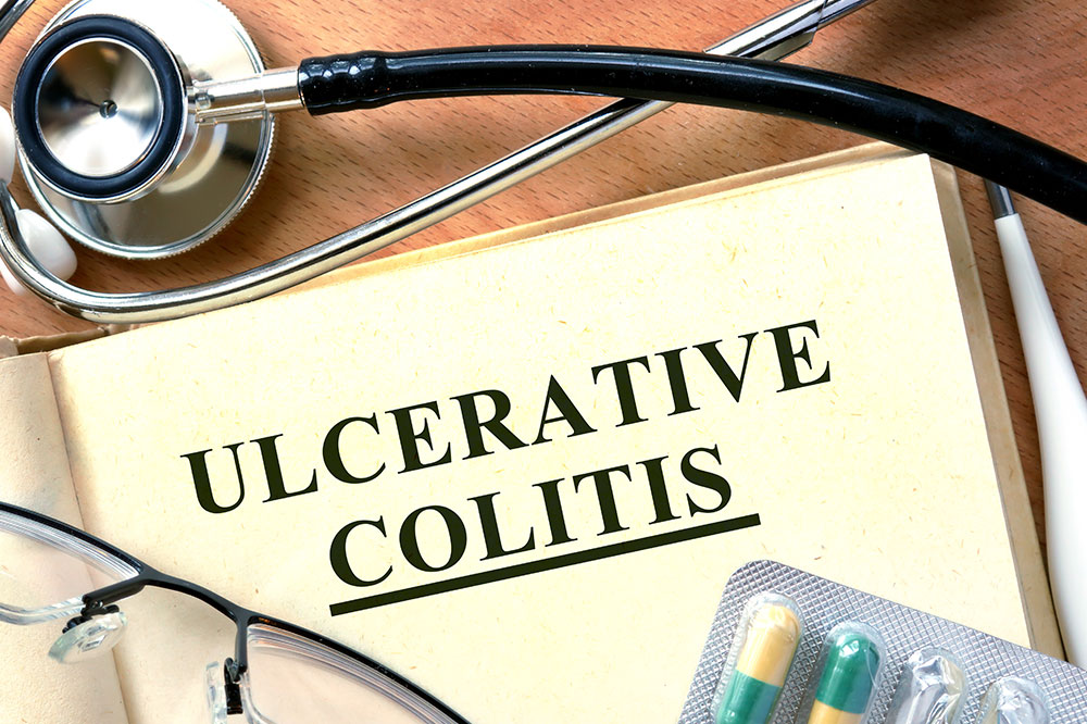 How Probiotics Help Ulcerative Colitis