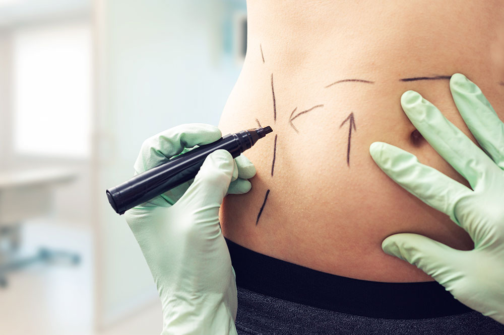 Plastic Surgery for Scars – The Process